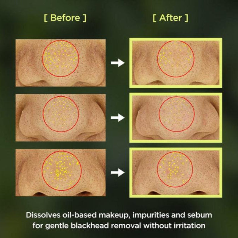 [Anua] Huile Nettoyante Contrôle de Pores Heartleaf